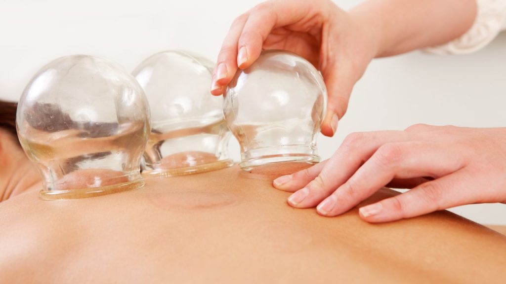 Formation Ventouses et Moxas
